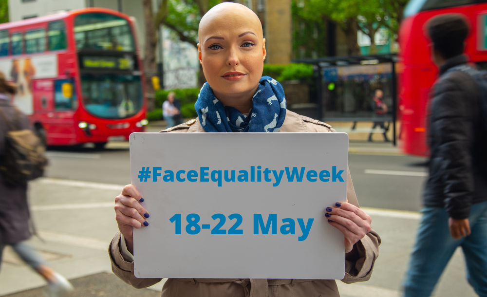 Adam Pearson face equality week